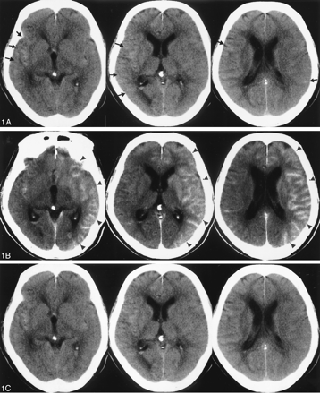 Fig 1.