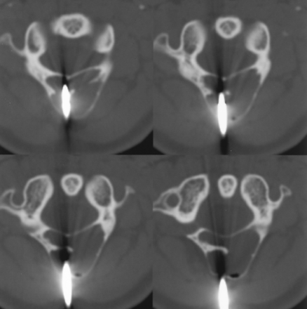Fig 2.
