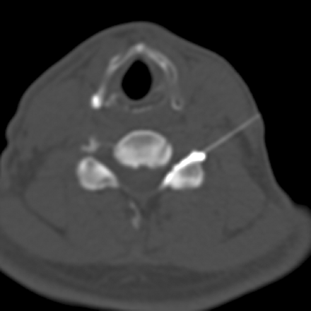 Fig 2.