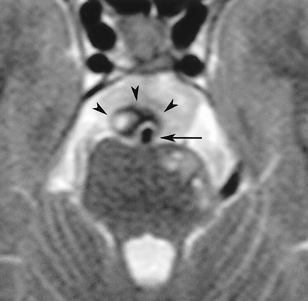 Fig 2.