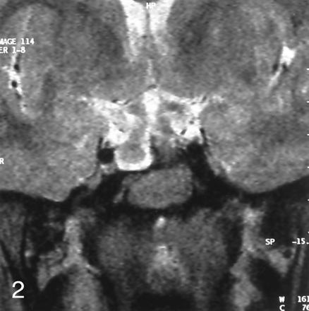 Fig 2.
