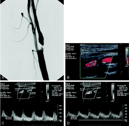 Fig 4.