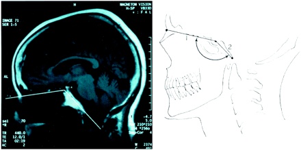 Fig 1.
