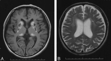 Fig 2.