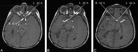 Fig 3.