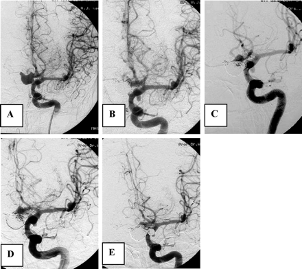 Fig 6.