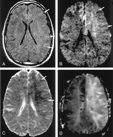 Fig 3.