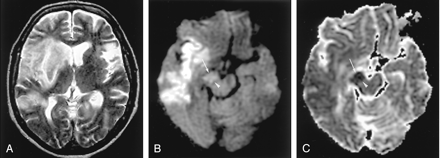 Fig 4.