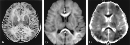 Fig 5.