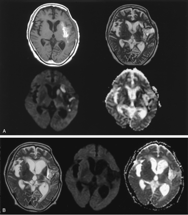 Fig 3.