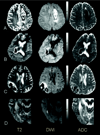 Fig 2.