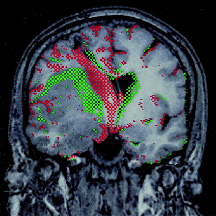 Fig 3.