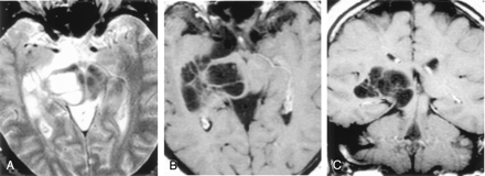 Fig 2.