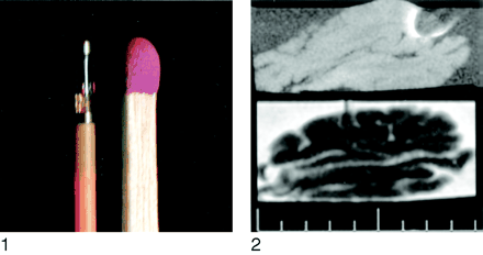 Fig 1.