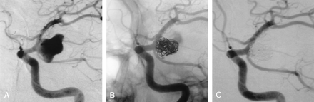 Fig 1.