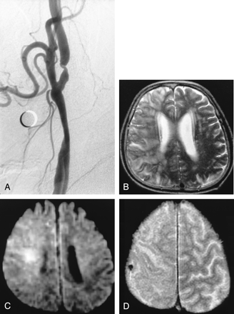 Fig 2.