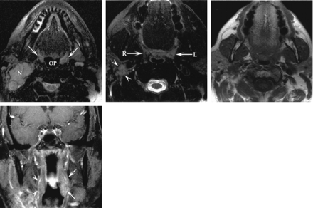 Fig 2.