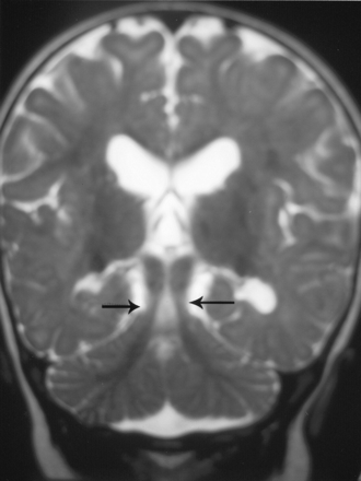 Fig 3.