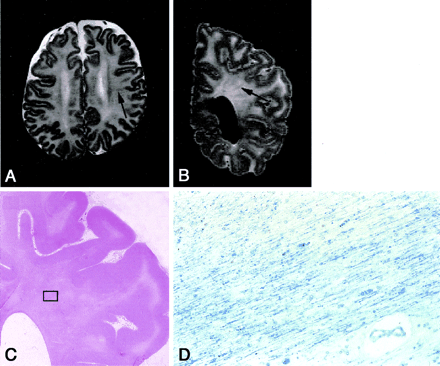 Fig 1.