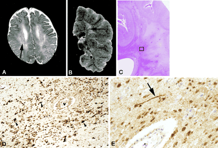 Fig 3.