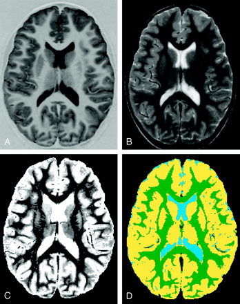 Fig 1.