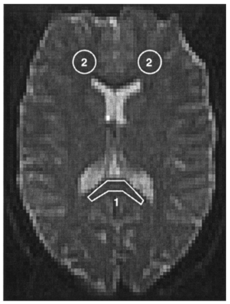 Fig 1.