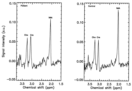 Fig 2.