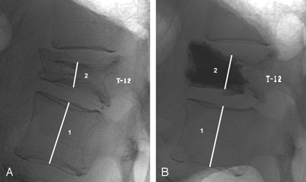 Fig 2.