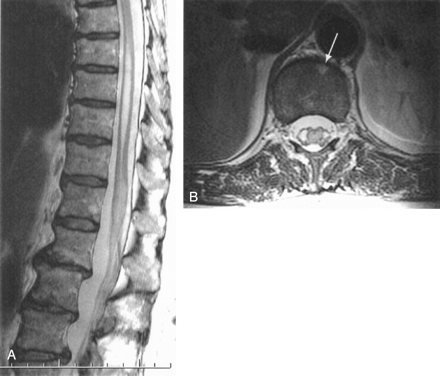 Fig 2.
