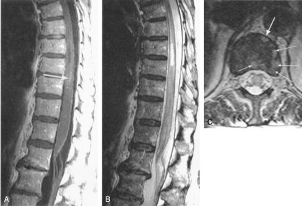 Fig 3.