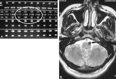 Fig 1.