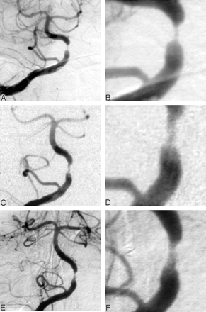 Fig 3.