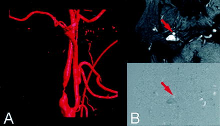 Fig 2.