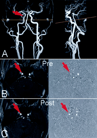 Fig 3.