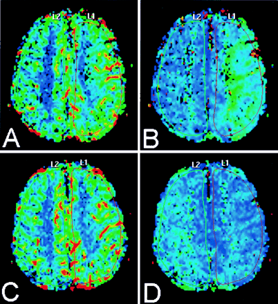 Fig 4.