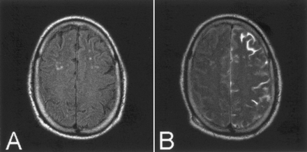Fig 5.