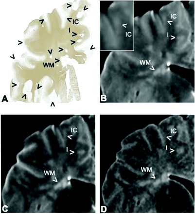 Fig 1.