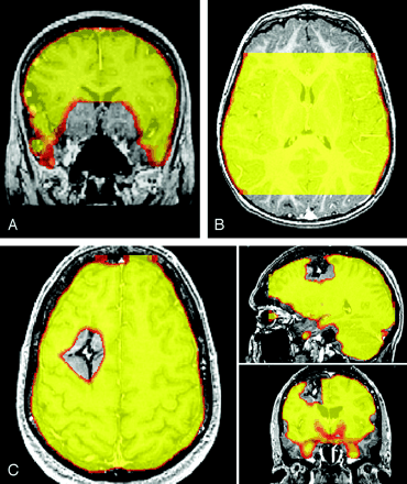 Fig 2.