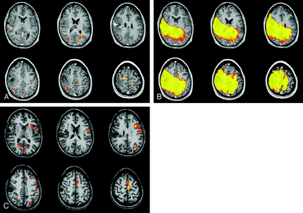 Fig 4.