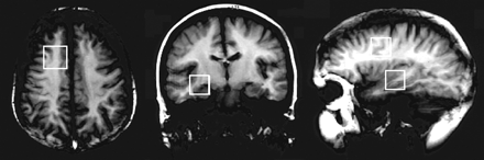 Fig 2.