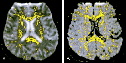 Fig 1.