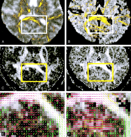 Fig 3.