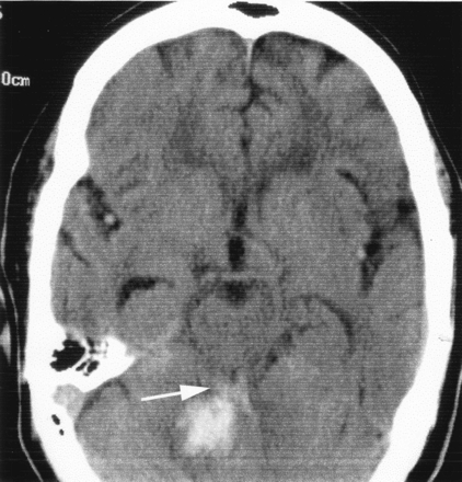 Fig 2.