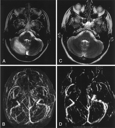 Fig 2.