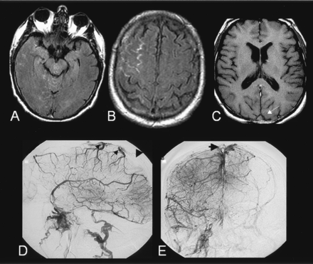 Fig 1.