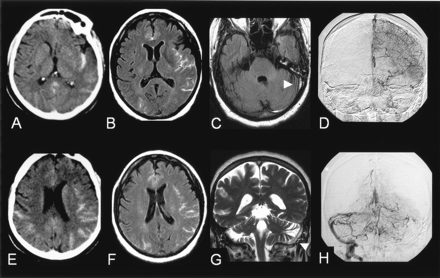 Fig 2.