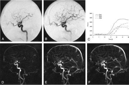 Fig 2.
