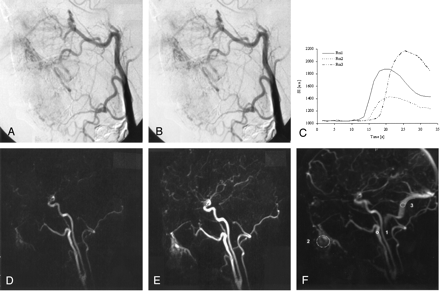 Fig 3.