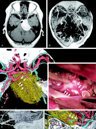 Fig 4.