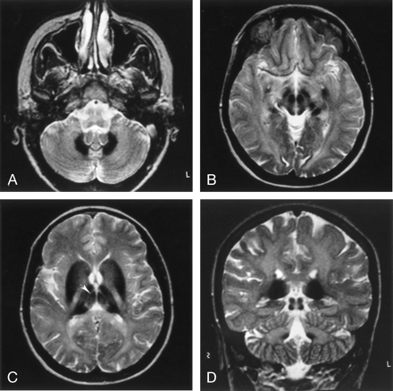 Fig 1.